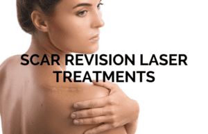 Scar revision laser treatments cover photo - Revive Laser