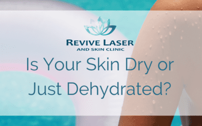Understanding & Treating Your Dry Skin