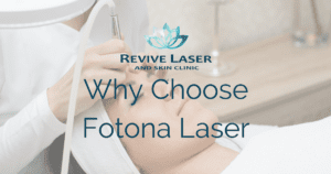 why choose fotona laser blog photo - Revive Laser