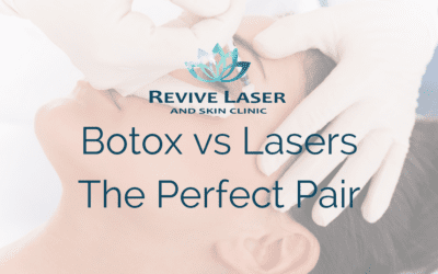 Botox vs Lasers – the perfect pair!