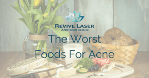 The worst foods for acne blog photo - Revive Laser