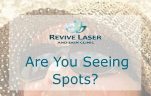 Are you seeing spots blog cover - Revive Laser