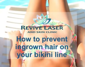 girl in bikini - Revive Laser