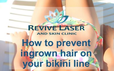 How to prevent ingrown hair on your bikini line