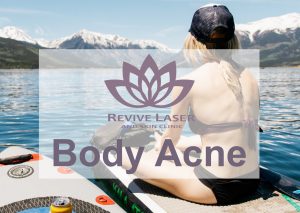 woman sits on paddle board and enjoys mountain view | Revive Laser