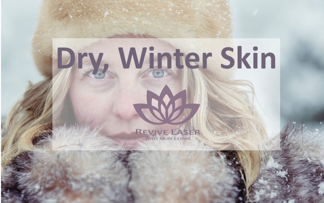 Dry, Winter Skin!
