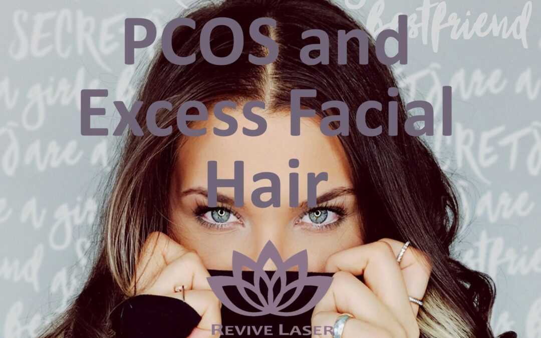 PCOS and Facial Hair Growth - Revive Laser and Skin Clinic